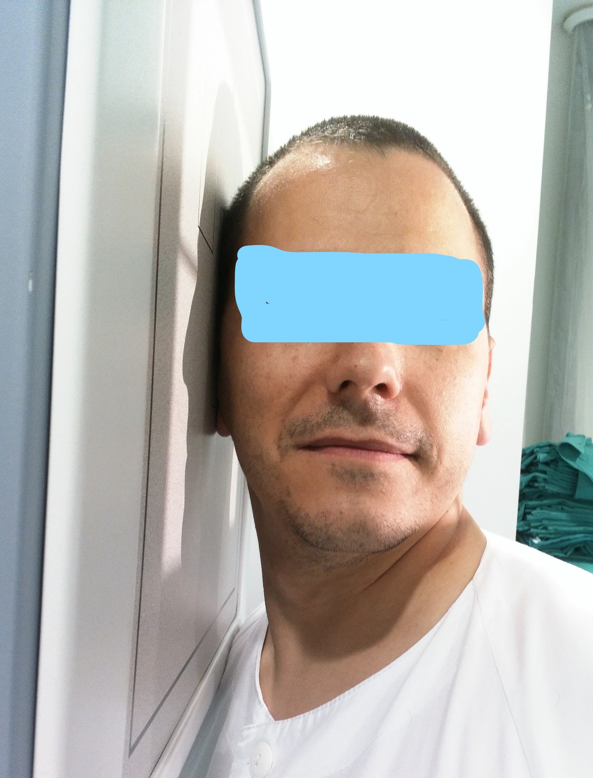 Anatomía Lateral Cráneo